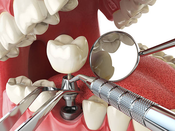 Best Walk-In Emergency Dentist in Sheboygan, WI